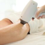 Épilation définitive au laser