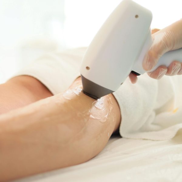 Épilation définitive au laser Épilation définitive au laser
